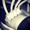 SculpSure 8