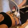SculpSure 14