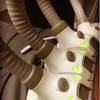 SculpSure 6