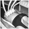 SculpSure 16